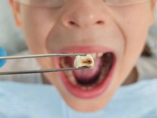 Best Weekend Emergency Dentist in West Wyoming, PA